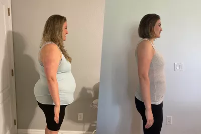 Stephanie Brown Before and After