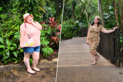 Meagan Before and After surgery