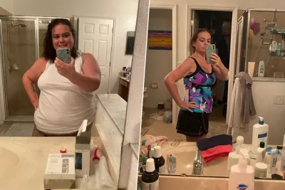 Caitlyn Before and After Surgery