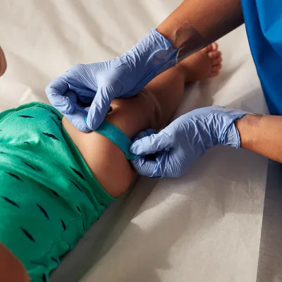A nurse places a bandage on a baby's leg in the urgent care.