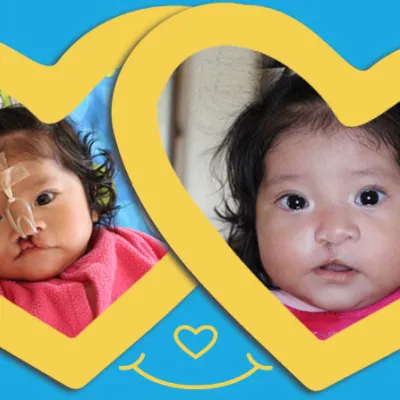 a before and after photo of baby flor