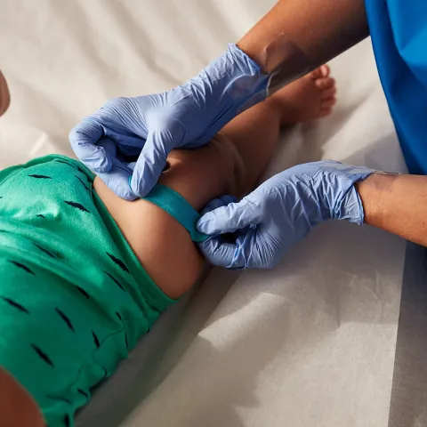 A nurse places a bandage on a baby's leg in the urgent care.