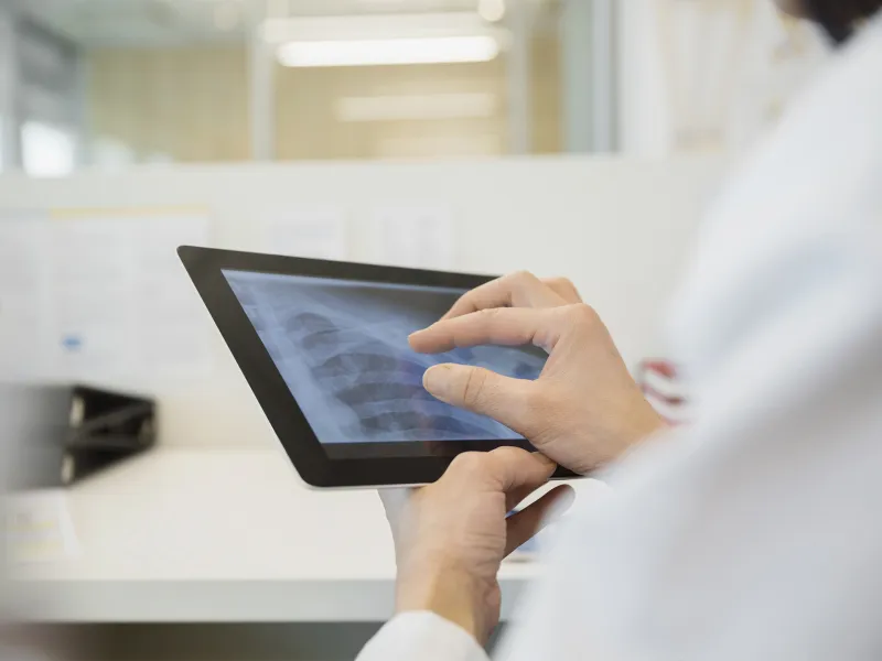 Close-up of a physician examining an x-ray.