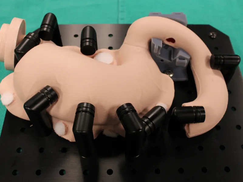Photo of an apullectomy model