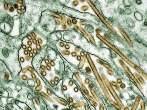 A microscopic image of H5N1 virus particles.