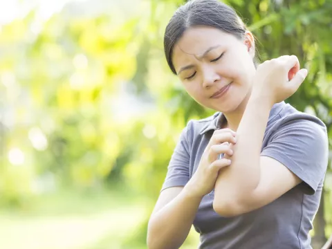 A woman scratches an itchy rash on her arm.