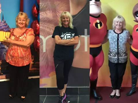 Photos of Donna Stanket before and after her bariatric procedure.