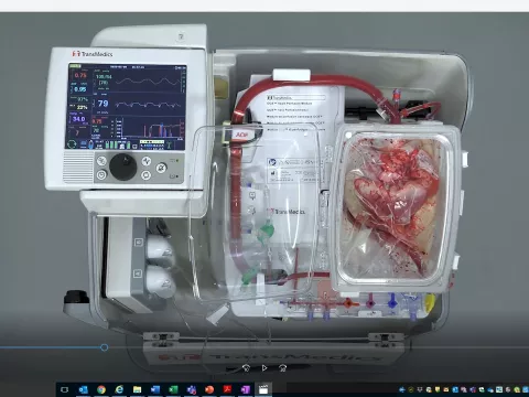 looking down at a device that keeps hearts of diseased donors pumping