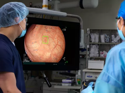 Surgeons utilize the groundbreaking GI Genius™ AI module during a colonoscopy, enhancing polyp detection by up to 50% and setting a new standard in colorectal cancer prevention and early diagnosis.