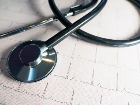 thransthoracic-echocardiogram