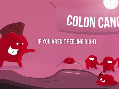 Trust Your Gut: Colon Cancer