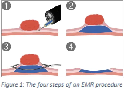 EMR