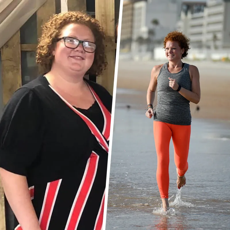 Chelsea Before and After Bariatrics