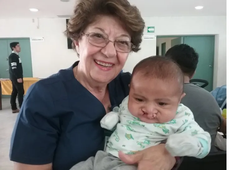 foundation-sharing-smiles-maryam dorri-cleft-baby-1
