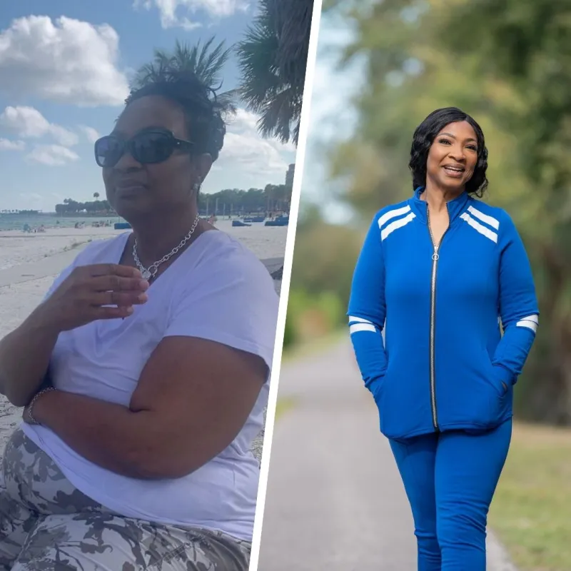 Bariatric patient Katrina's before and after photos.