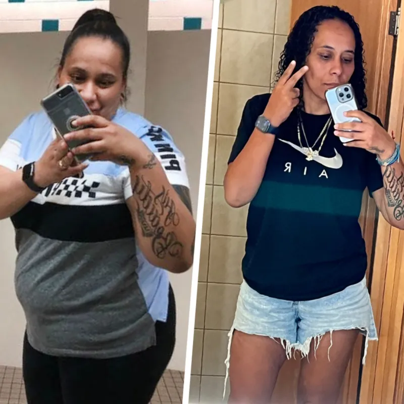 Michelle Before and After Bariatrics