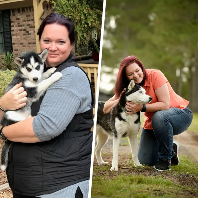 Patricia Before and After Bariatrics