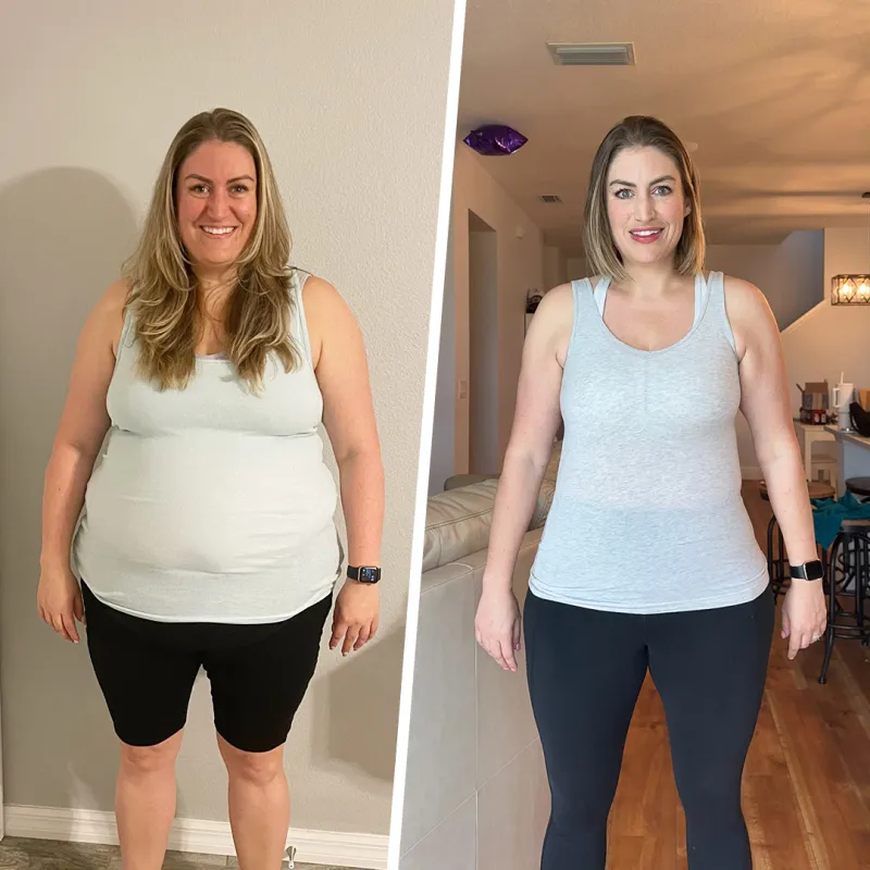 Stephanie Before and After Bariatrics